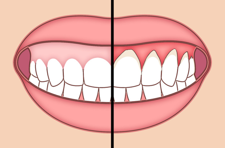 شش اقدامی که دندان هایتان به آن نیاز دارند