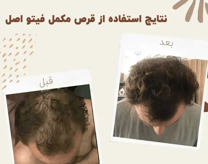 قرص فیتو phyto چیست؟ خرید و قیمت مکمل فیتو اصل ضد ریزش مو ایتالیایی 4