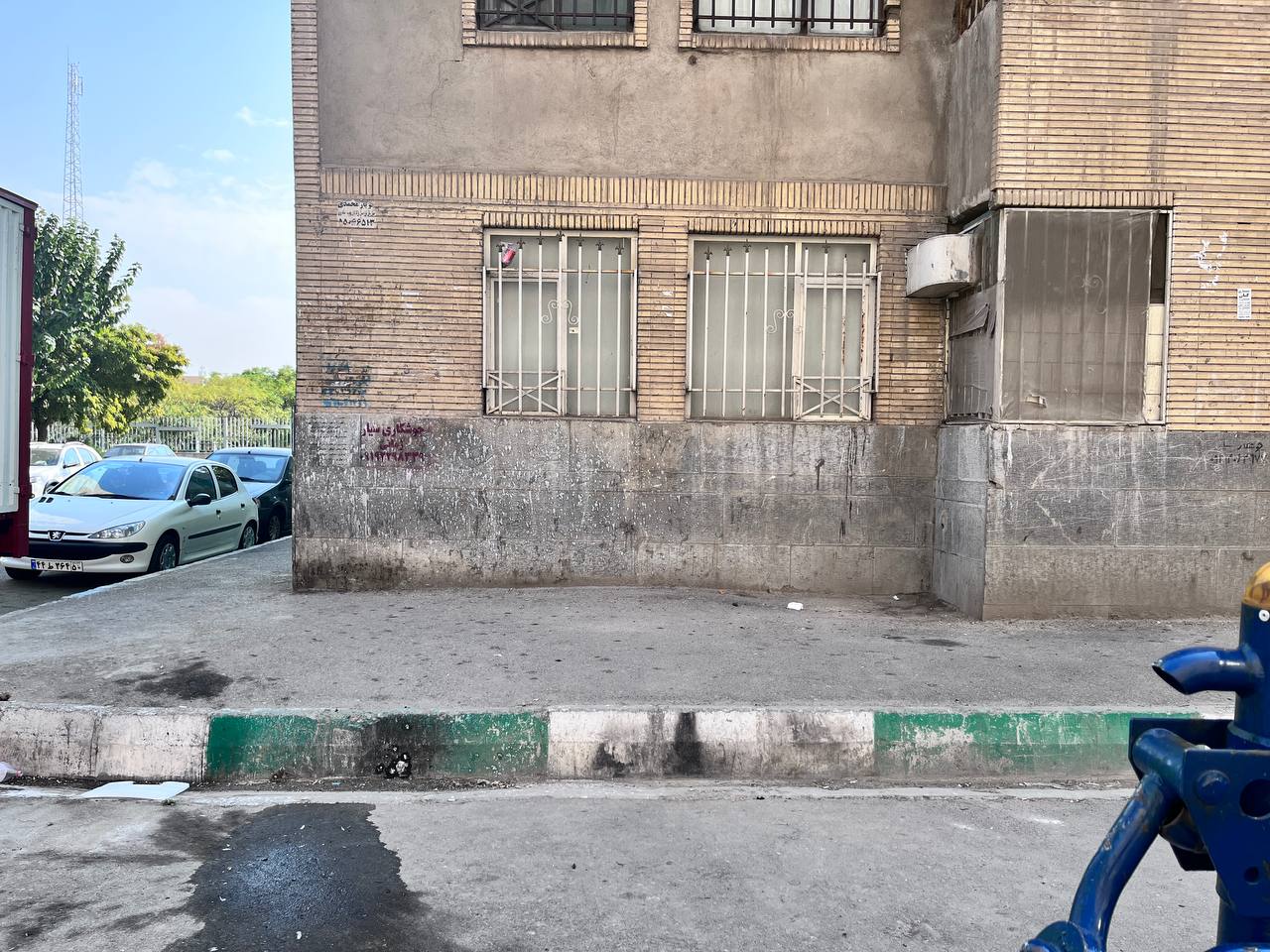 اسیدپاشی روی نوجوان تهرانی