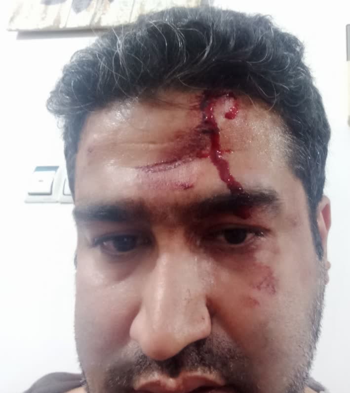 حمله با چاقو به یک استاد دانشگاه در کرج