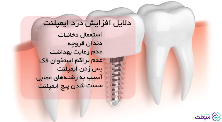 آیا ایمپلنت دندان درد دارد؟ 2