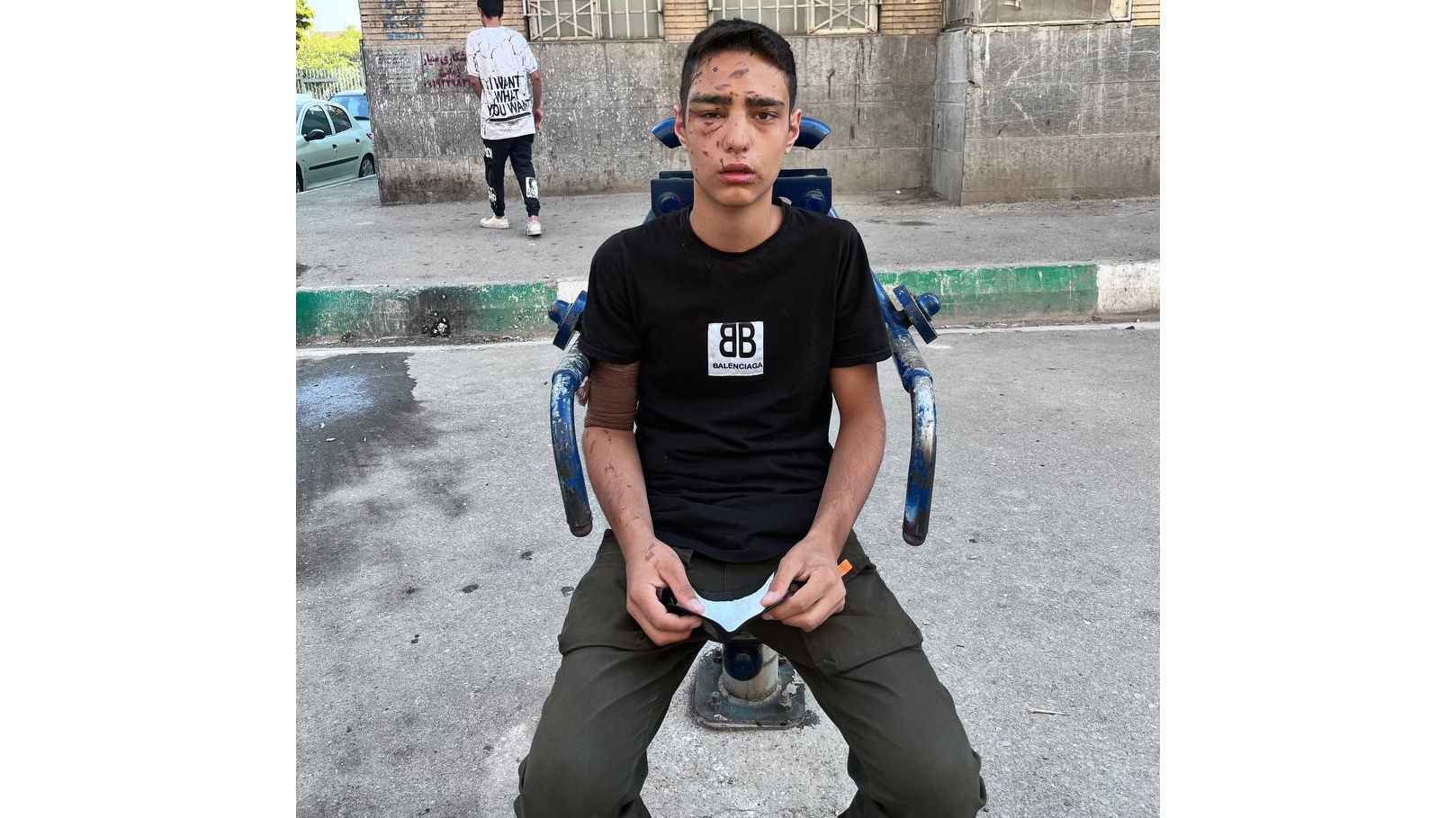 اسیدپاشی روی نوجوان تهرانی