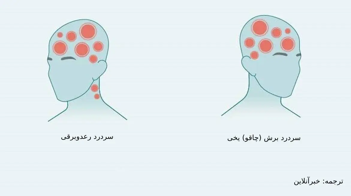 سردرد