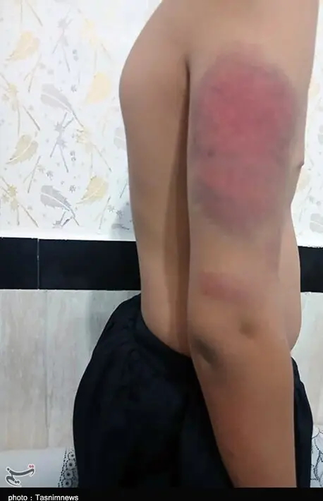 کتک2