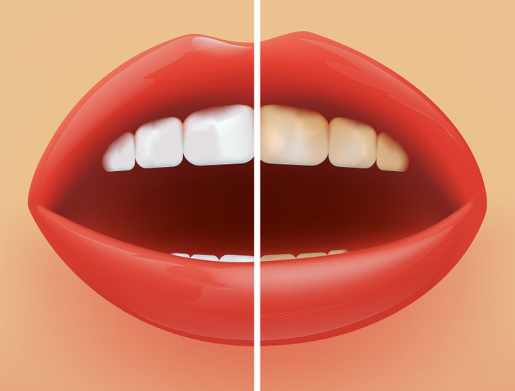شش اقدامی که دندان هایتان به آن نیاز دارند