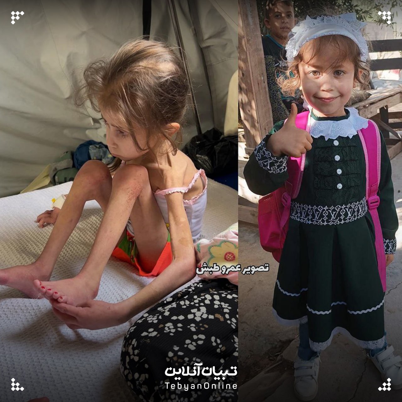 تصویری از دردناک از بلایی که جنگ غزه بر سر این دختربچه آورده است + عکس 2