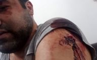 حمله هولناک به یک استاد دانشگاه با چاقو در کرج + عکس