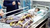 (14+) آوا دختر 4 ساله ارومیه ای براثر شدت شکنجه نامادری اش درگذشت / جزییات ‌تکان‌دهنده‌