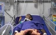 مرگ و نابینایی در حادثه مسمومیت الکلی 20 نفر در خوزستان