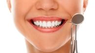 سریع ترین روش سفید شدن دندان در خانه چیست؟ 8 روش سفید کردن دندان