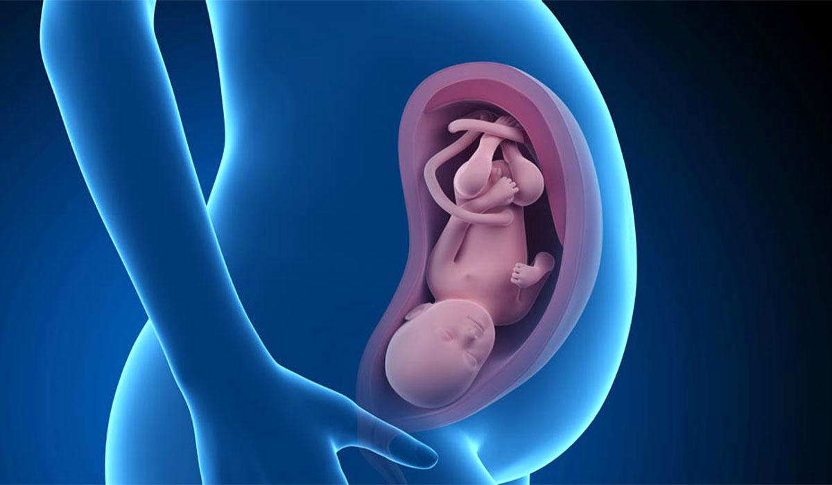 1400 جنین در ایران سقط شدند 