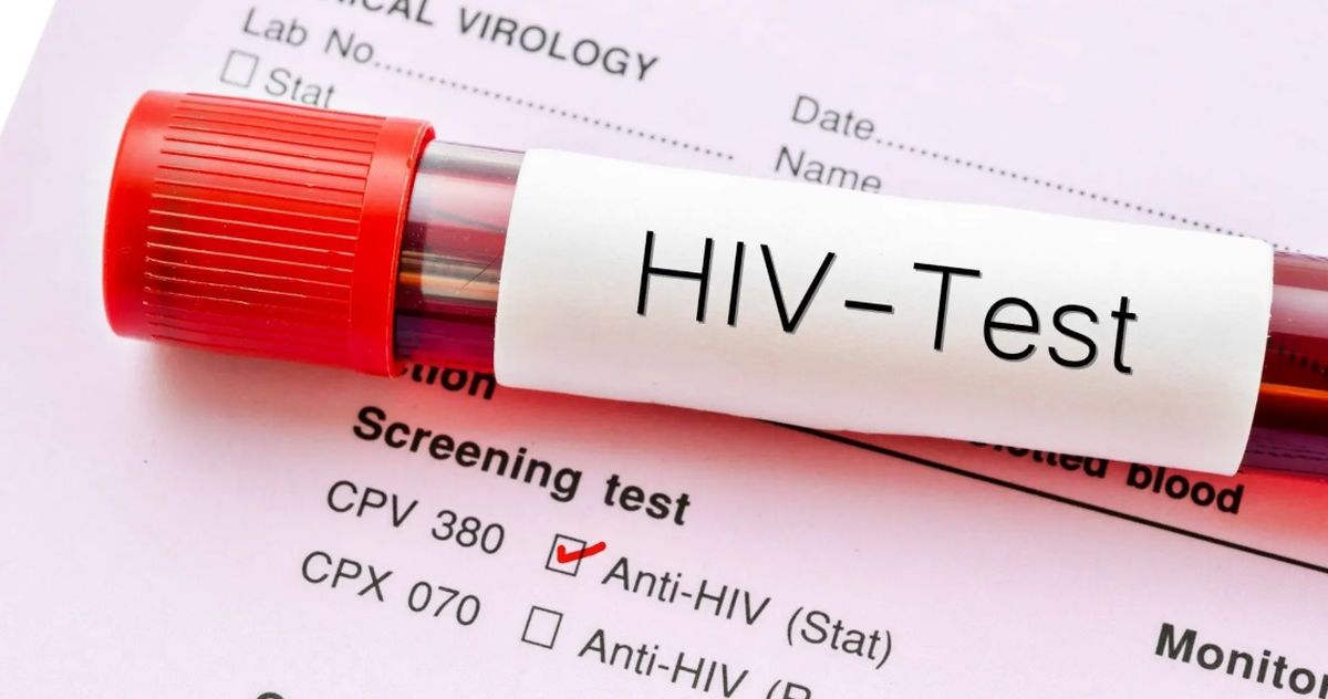 سه باور غلط درباره بیماری ایدز که باید بدانید