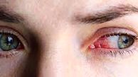 راز لکه‌های قرمز داخل چشم 