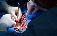 درآمد جراحان قلب در بیمارستان‌های دولتی چقدر است؟
