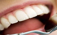 راه درمان پیله دندان کشف شد