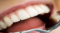 ابلاغ تعرفه دندانپزشکی برای اولین بار در ایران