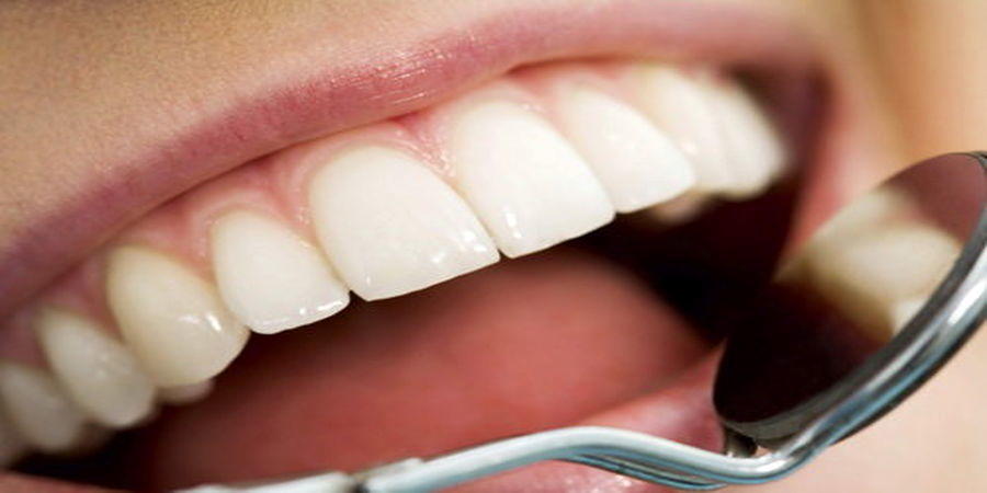 دندان‌ها چرا جرم می‌گیرند؟+راه درمان