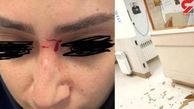 ضرب و شتم  دردناک یک خانم پرستار در تالش + عکس

