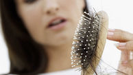 چند نفر مهم برای جلوگیری از ریزش مو