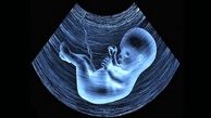 سقط مکرر جنین چه بلایی سر مادر می‌آورد؟