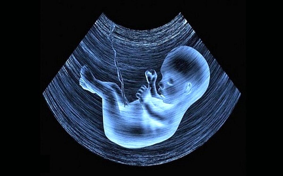 سقط مکرر جنین چه بلایی سر مادر می‌آورد؟