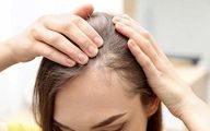 ریزش مو نشانه چه بیماری است؟