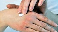 8 راهکار طلایی برای درمان خشکی پوست