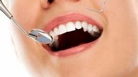برای جلوگیری از پوسیدگی دندان چه باید کرد؟