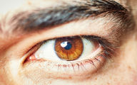 کدام علائم چشمی نشان دهنده کرونا هستند؟