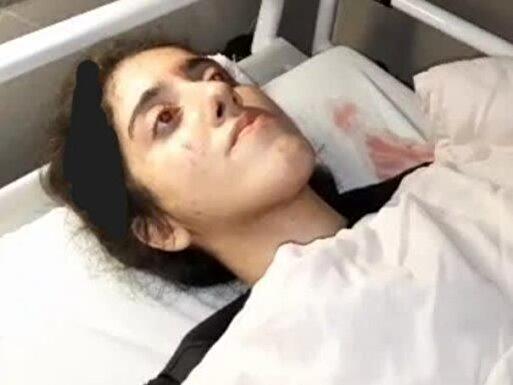 اطلاعیه پلیس  درباره  کشته شدن دختر ۲۰ ساله در پیاده راه فرهنگی رشت:/  او از ناحیه سر دچار آسیب شده /عکس