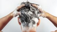 برای جلوگیری از ریزش مو چندبار در هفته حمام کنیم؟