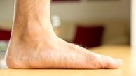 چگونه صافی کف پا را درمان کنیم؟