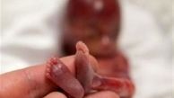 سقط جنین در ایران دخترانه شد؟ مجازات سِقط عمدی چیست