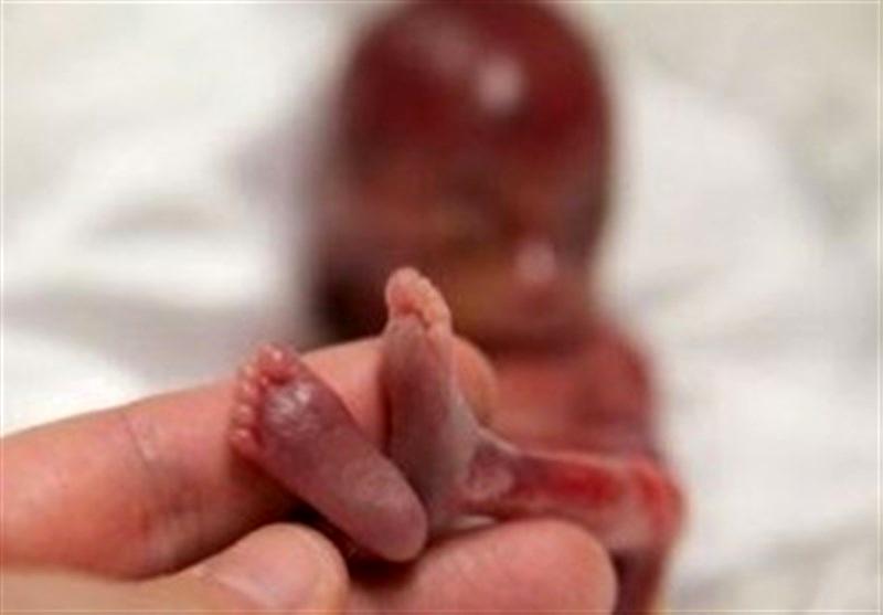 سقط جنین در ایران دخترانه شد؟ مجازات سِقط عمدی چیست