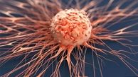 شایع‌ترین سرطان‌های زنان را بشناسید