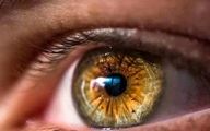 اقدام خطرناک برخی مردم برای تغییر رنگ چشم با ۲۵۰ میلیون تومان