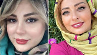 بازیگران زن ایرانی که کتک خوردند! + عکس گریم‌های جنجالی 