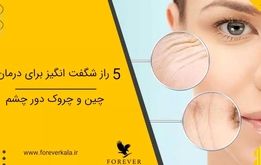 5 راز شگفت انگیز برای درمان چین و چروک دور چشم
