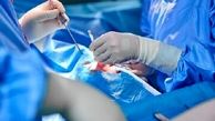 انجام اولین جراحی روی مغز دختر 12 ساله در ایران
