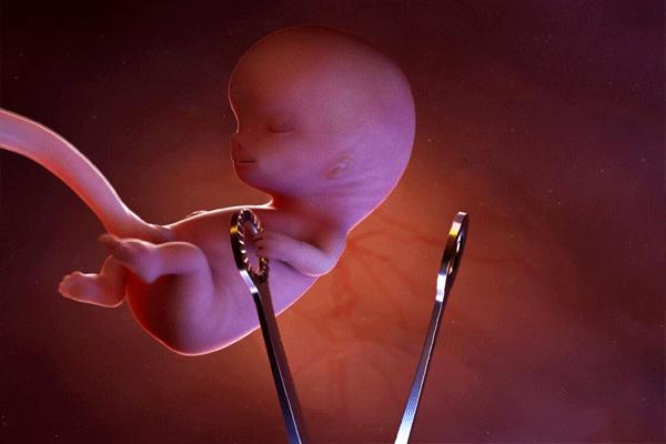 10 خطر جدی سقط جنین؛ از ابتلا به سرطان تا ناباروری دائم+عکس