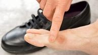 هشدار؛ عوارض خطرناک کفش نامناسب برای سلامتی/ از بیماری عفونی تا پوستی