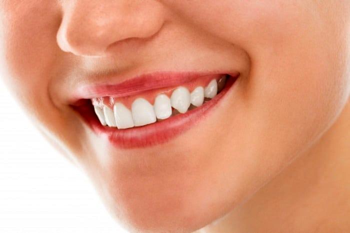 10 راز سفید کردن دندان‌ها در خانه