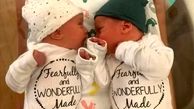 تولد نوزاد دوقلویی که رویان آنها 30 سال پیش منجمد شده بود +عکس