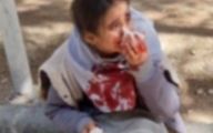 ماجرای جنجالی صورت خون‌آلود دختر دانش‌آموز اصفهانی چیست؟