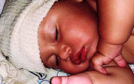 تولد نوزادی بدون انگشت دست و با پای ناقص + عکس