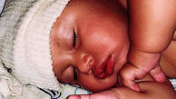 تولد نوزادی بدون انگشت دست و با پای ناقص + عکس
