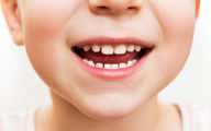والدین بخوانند | نکاتی ضروری درباره سلامت دندان کودکان