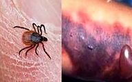 مراقب باشید! شیوع ویروس تب خونریزی‌دهنده کریمه کنگو در ایران