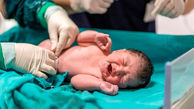 اتفاق بی‌سابقه در ایران؛ تولد نوزادی با ۷ کیلو وزن!
