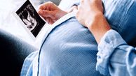 کدام گروه از زنان مبتلا به دیابت بارداری می‌شوند؟